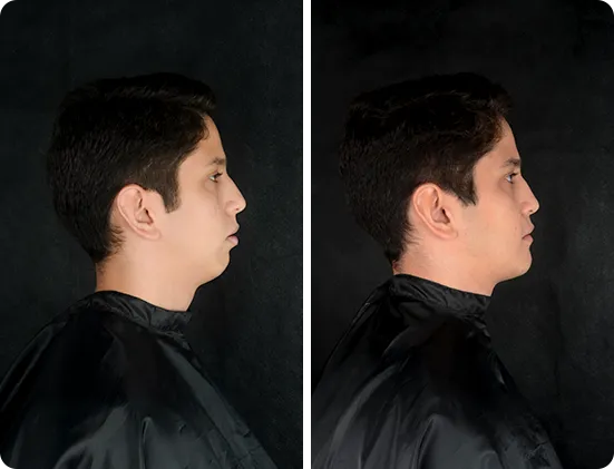 luis-casos-1