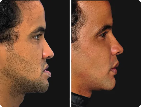 luis-casos-3